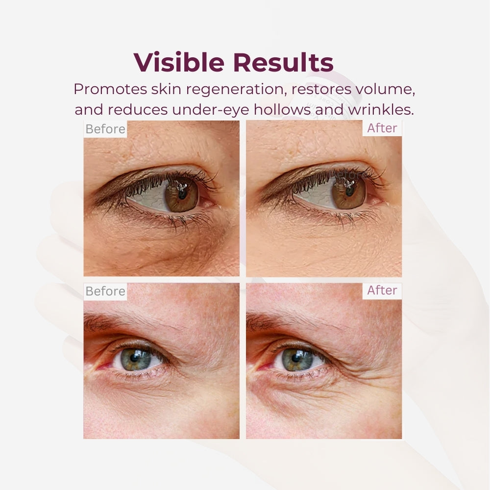 Zexhyn Calcium Wrinkle Repair Balm