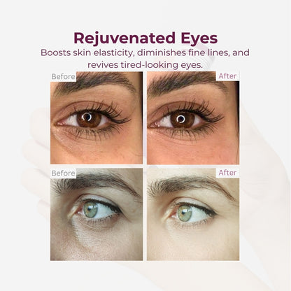 Zexhyn Calcium Wrinkle Repair Balm